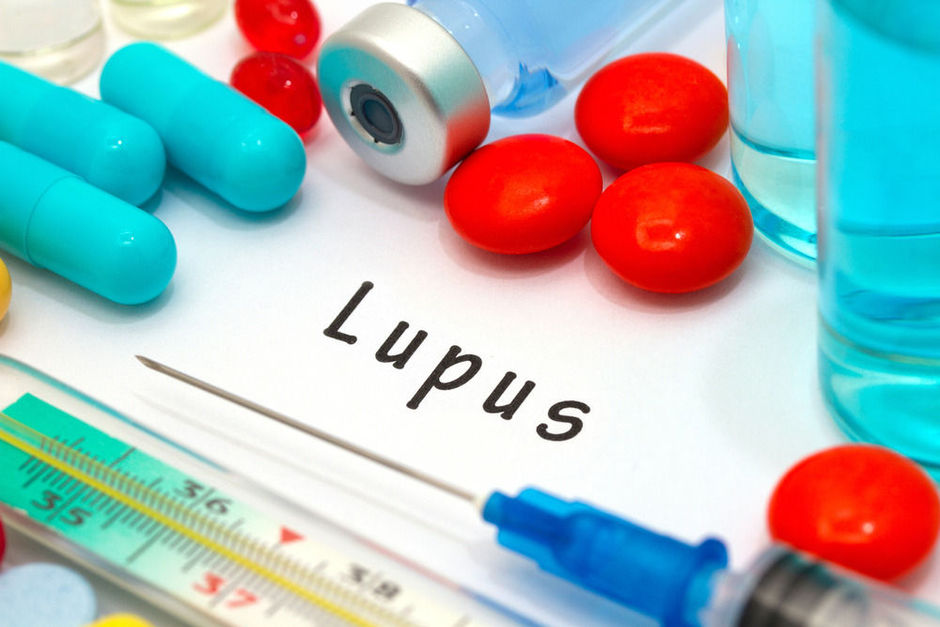 Lupus: Blimp-1, een veelbelovende therapeutische target