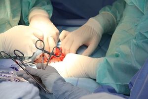 Bariatrische chirurgie verlaagt de sterfte bij zwaarlijvigen