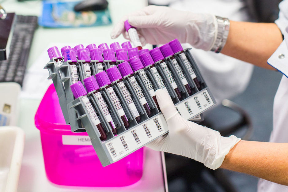 Acht soorten kanker detecteren en lokaliseren met multianalytisch bloedonderzoek