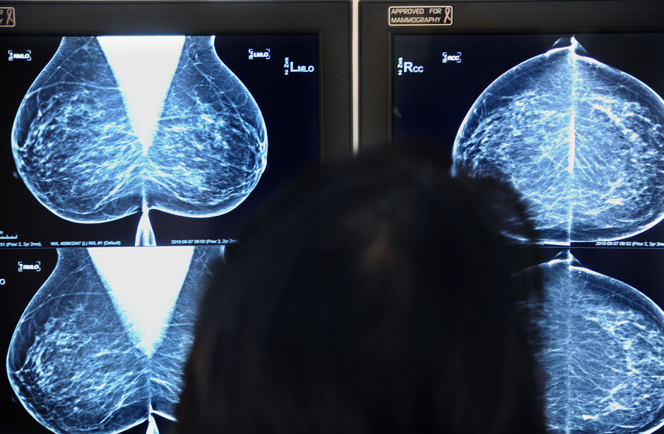 Riziv-rondschrijven over mammografieën verdaagd