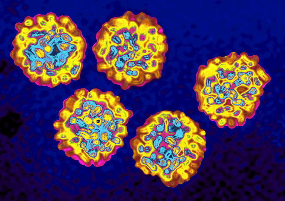 Hiv en hepatitis C: Zwitserse ervaring