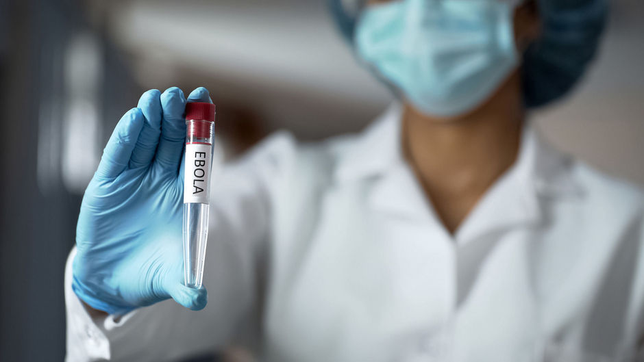 Antistof van Ebola-overlever sleutel tot universeel geneesmiddel?